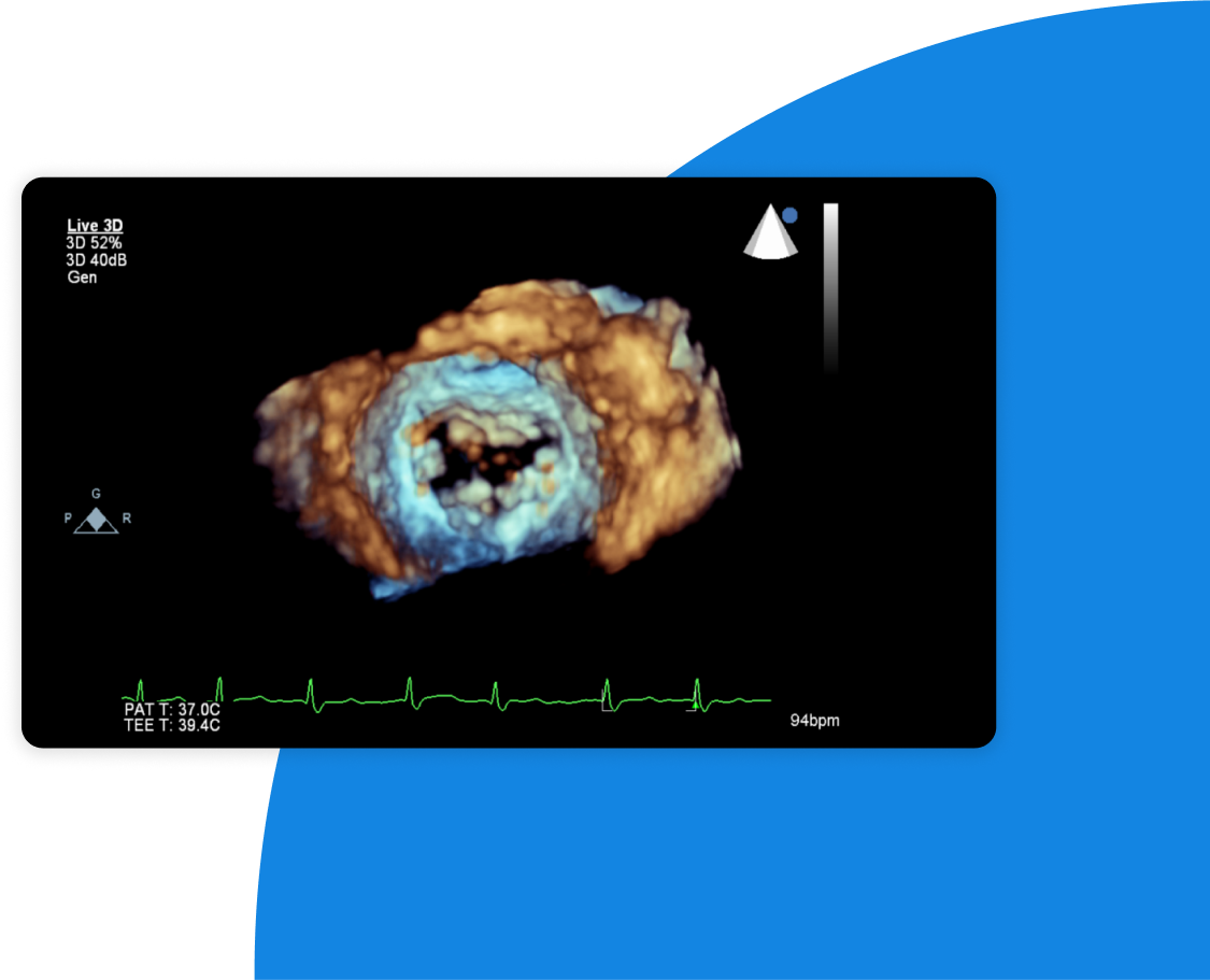 Screenshot of cardiovascular visualization experience within Merative Imaging product