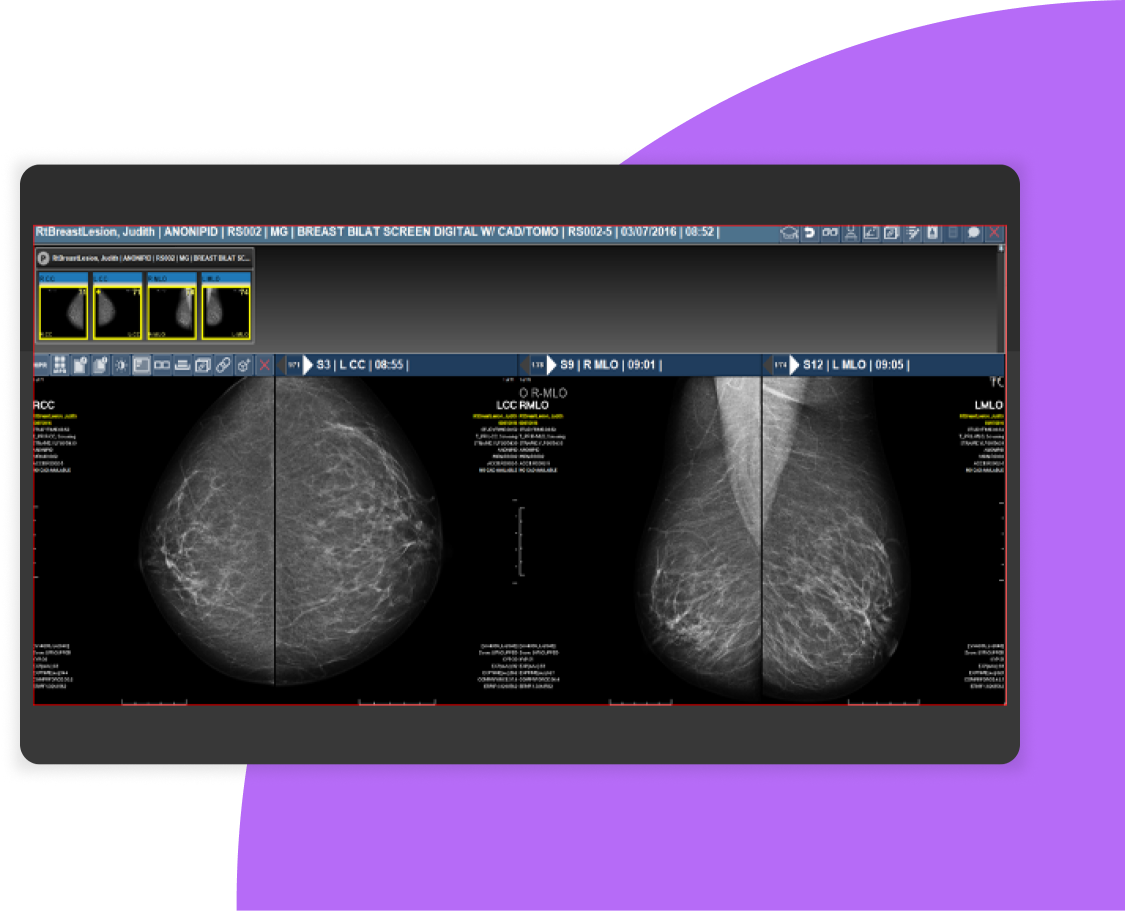 Mammography solution